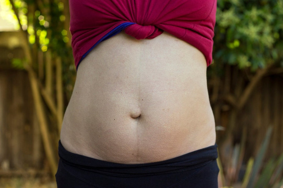 Diastasis Recti: What It Is and How to Treat It | 123 Baby Box