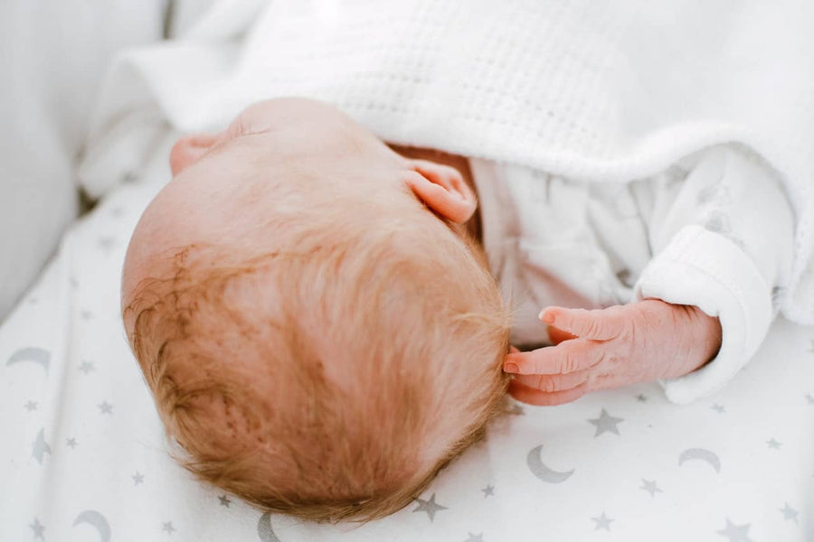 should you be concerned about your baby's hair loss?