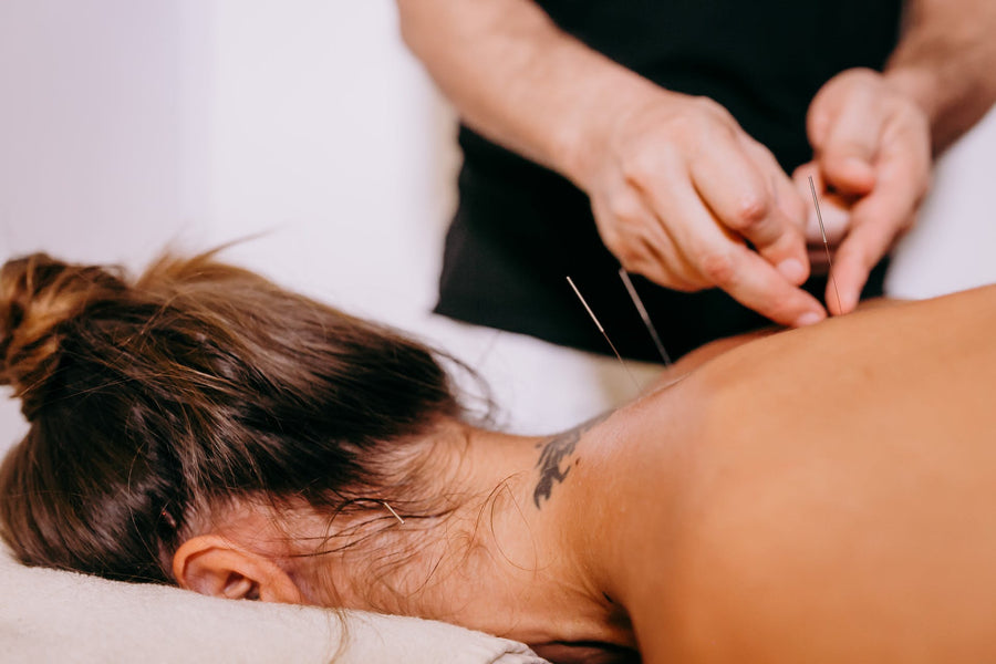 a pregnant woman getting acupuncture