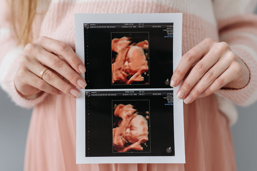 A pregnant woman holds up an ultrasound of a baby